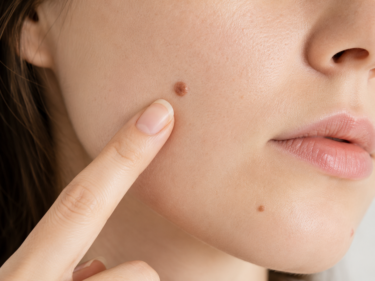 Close-up of a person pointing to a mole on their cheek